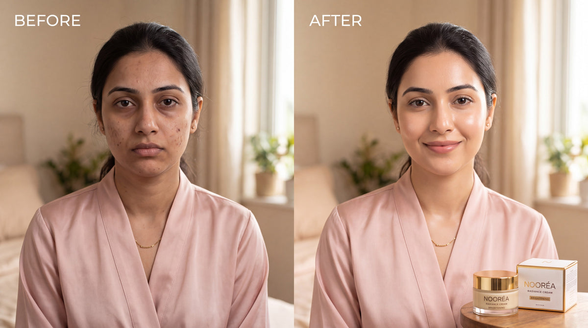 NOORÉA Brightening Cream – Glow-Boosting Skin Radiance Formula